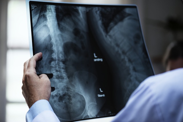 La ressonància magnètica per a la detecció d’alteracions del disc vertebral