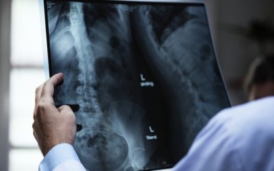 La resonancia magnética para la detección de alteraciones del disco vertebral
